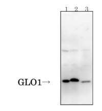 GLO1 | Glyoxalase I (clone 6F10) in the group Antibodies Human Cell Biology / Neuroscience / Neurodegenerative diseases / Alzheimer's disease at Agrisera AB (Antibodies for research) (AS21 4568)